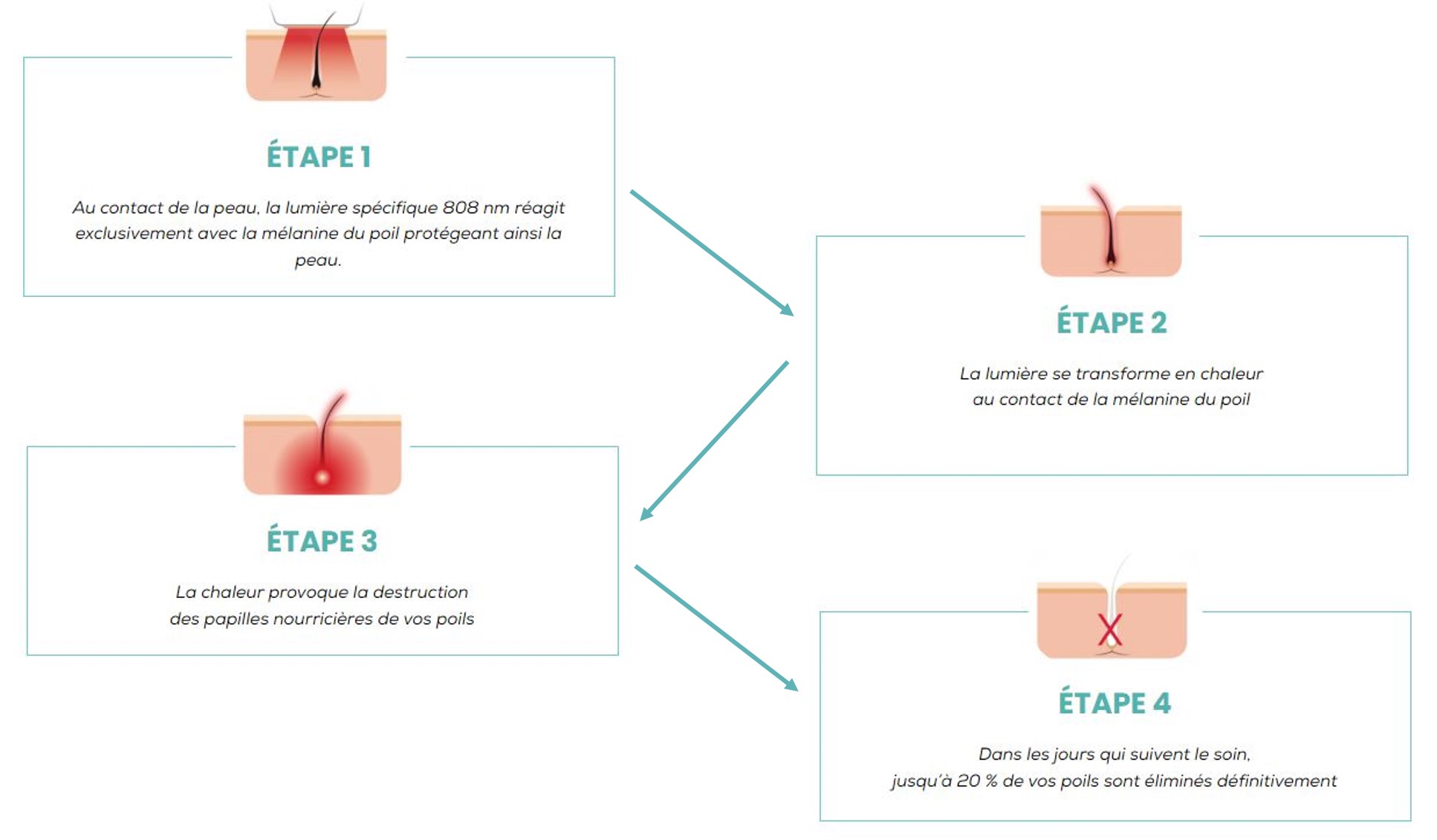 Epilation définitive au LASER
